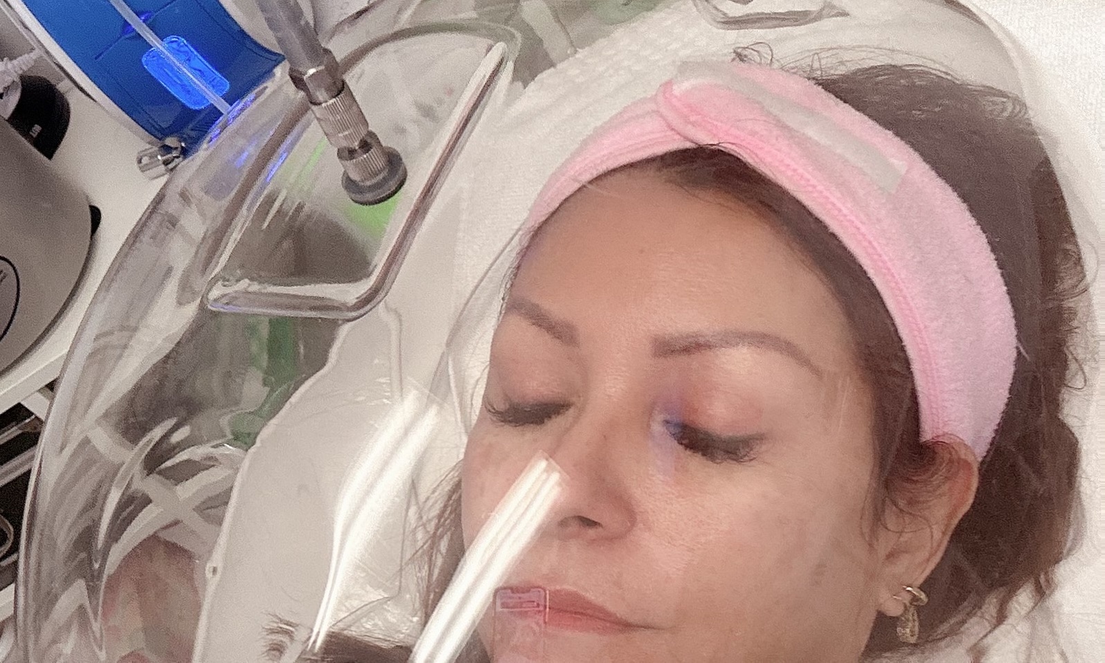 Up to 65% Off on Facial - Oxygen at Beauty Esthetic