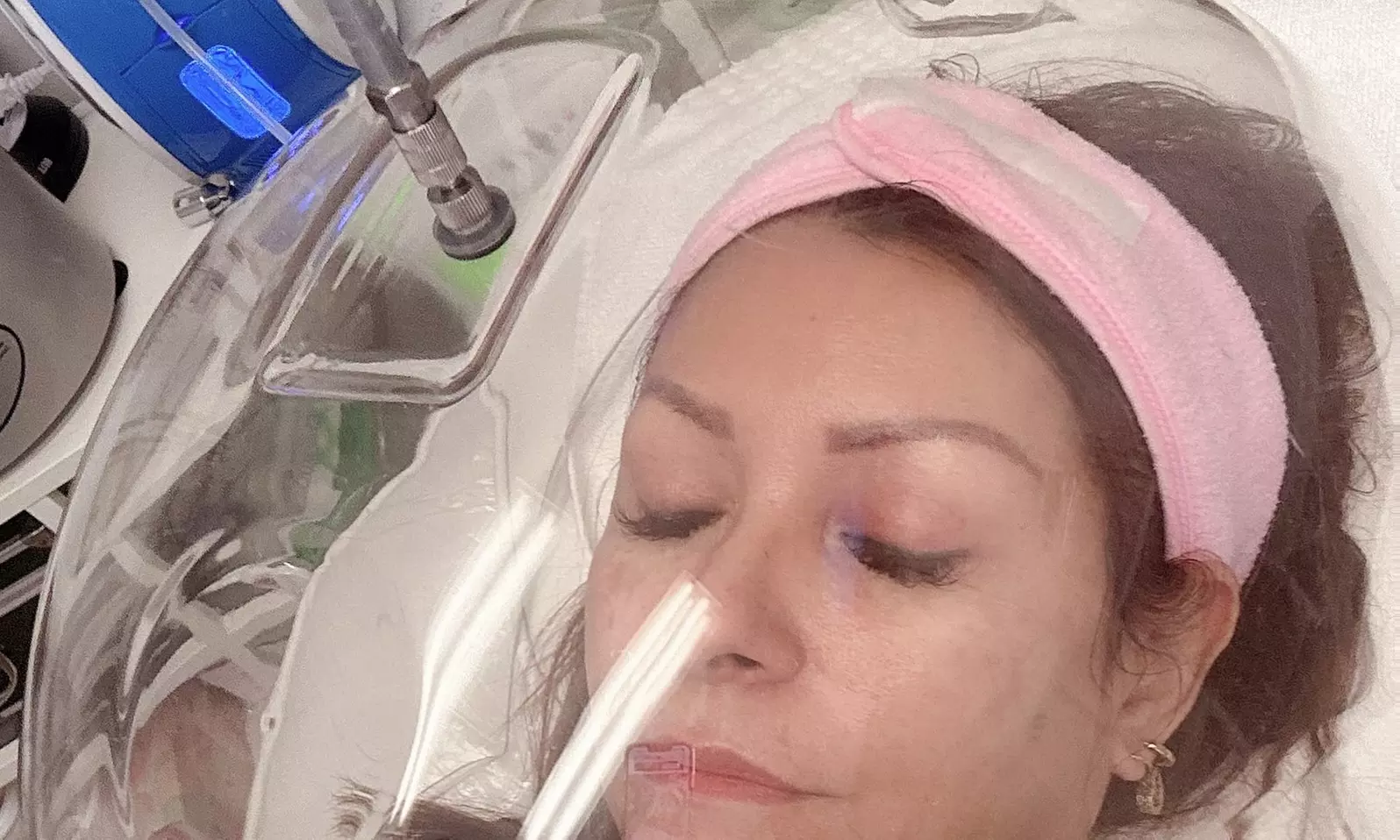 Up to 65% Off on Facial - Oxygen at Beauty Esthetic - Primary Image