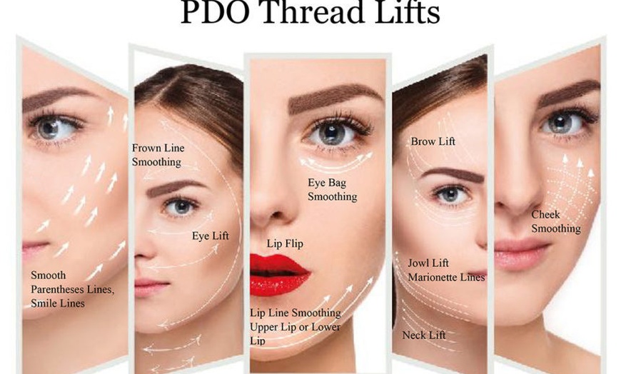 Image 5: Bella Hadid Style Eyebrow Lift With PDO Threads at No Pain All Gain Spa (Up to 30% Off)