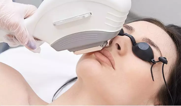 Up to 70% Off on IPL Photo Facial at Aesthetic Boutique Medspa - Primary Image