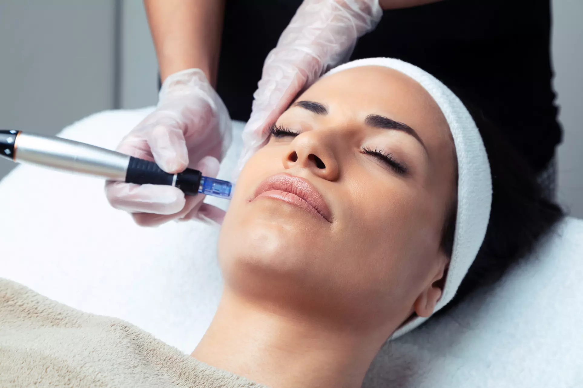Up to 52% Off on Micro-Needling at Elite Spine Health and Wellness - Primary Image