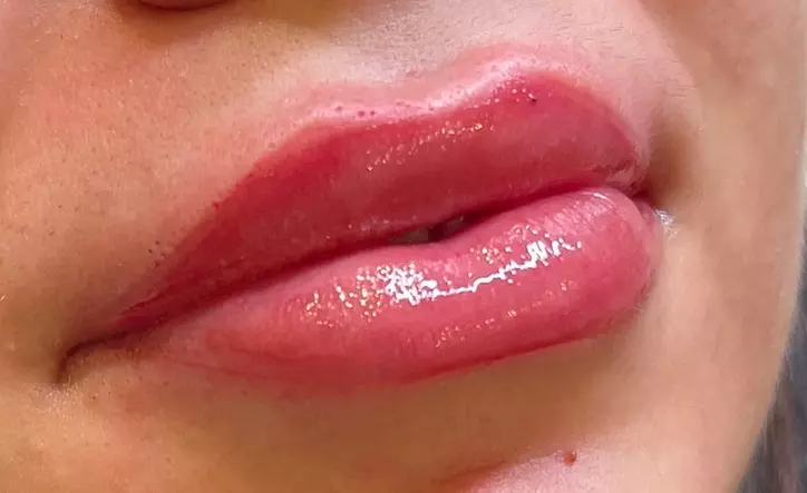 Permanent Make-up für den Wimpernkranz oder Augenlider bei Medforbody