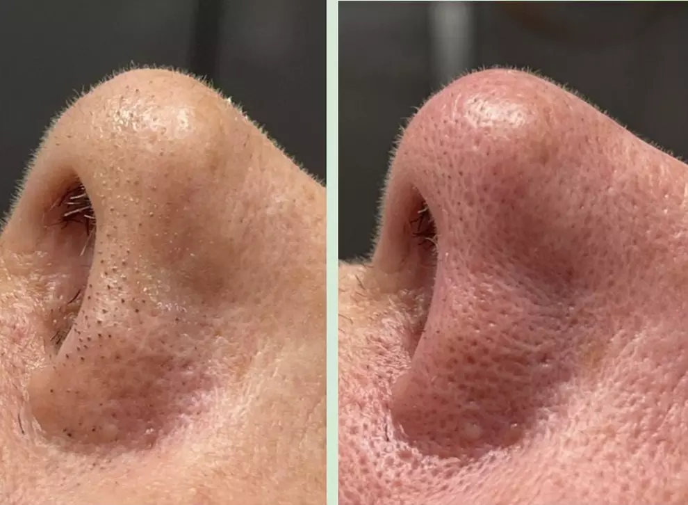 Refreshing 60-Minute Facial Options for Glowing Skin