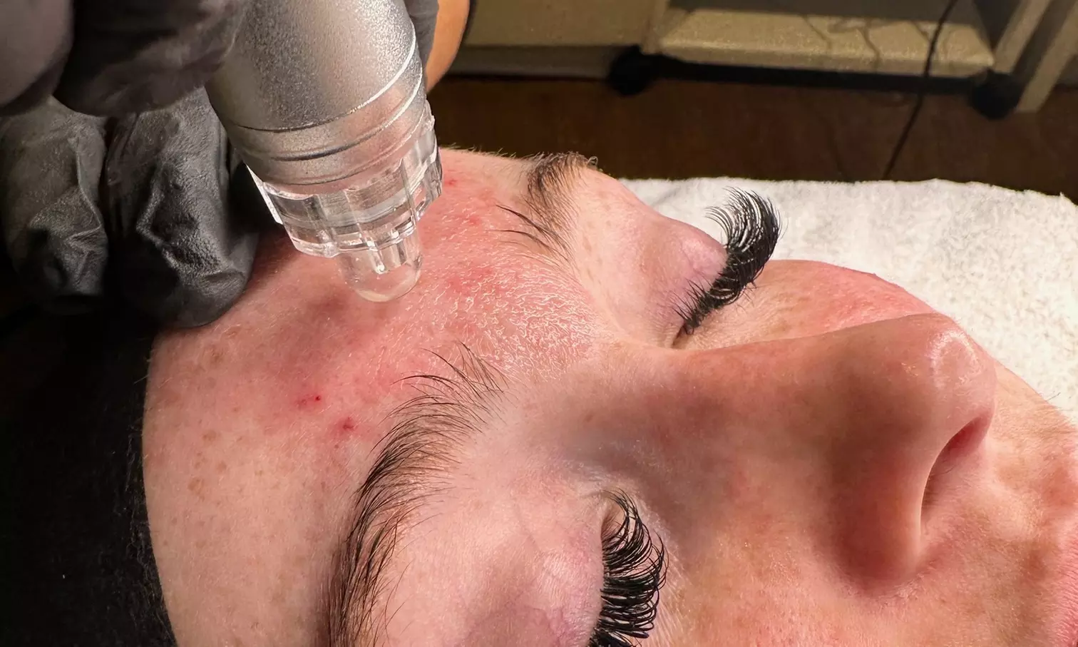 Up to 55% Off on Facial - Chosen by Customer at Viso Medi-Spa & Boutique