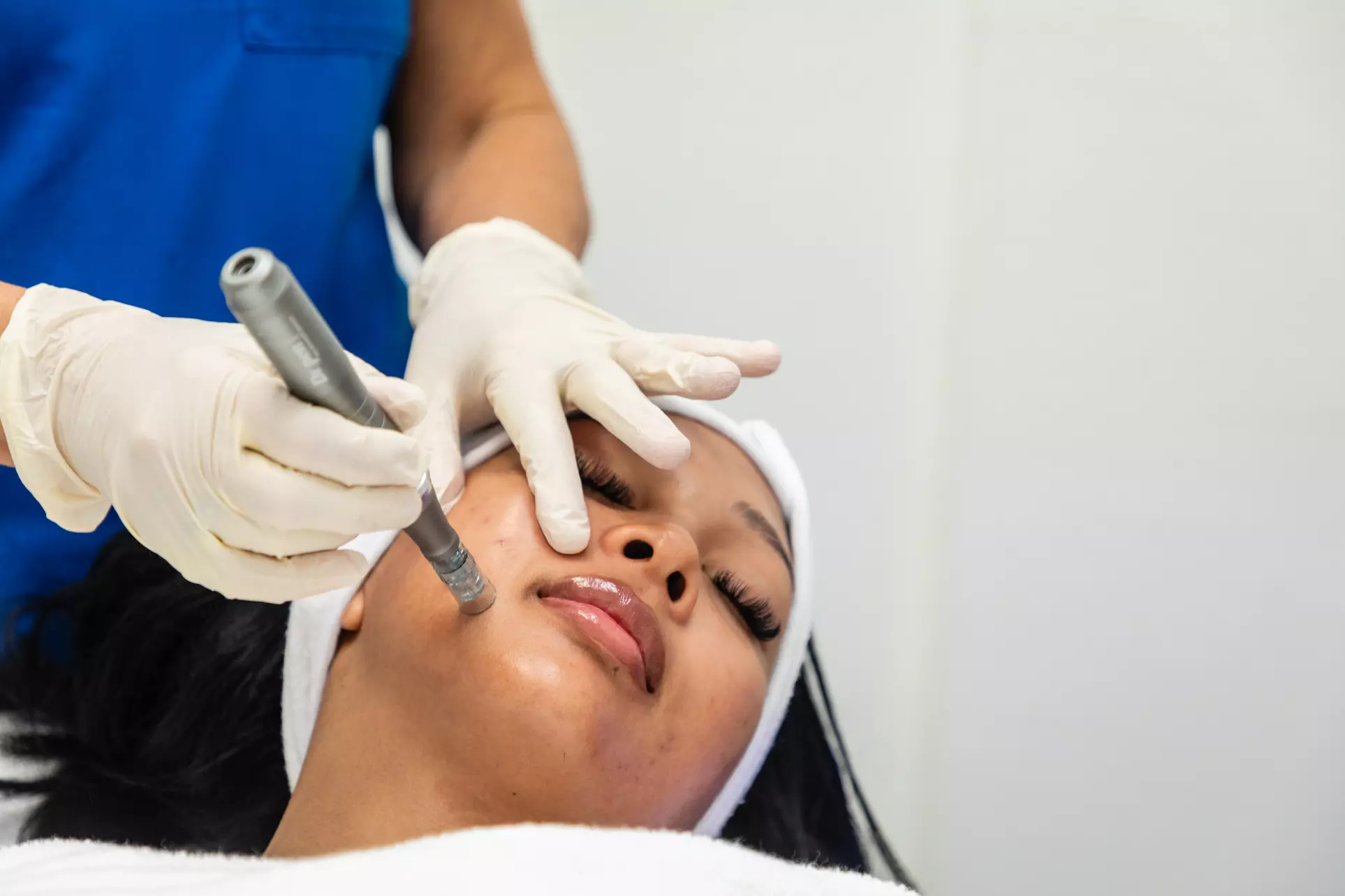 Experience Silk Skin Laser Spa's Mother's Day Special Microneedling Treatment with up to 30% off for a youthful glow - Primary Image
