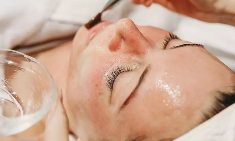 Up to 48% Off on Facial - Chemical Peel at Sycamore Cosmetic Clinic