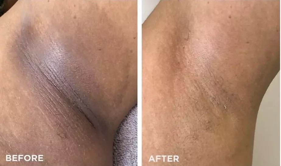 Experience Muma Aesthetics' Refreshing and Renewing Targeted Chemical Peels With Up to 35% Discount - Primary Image