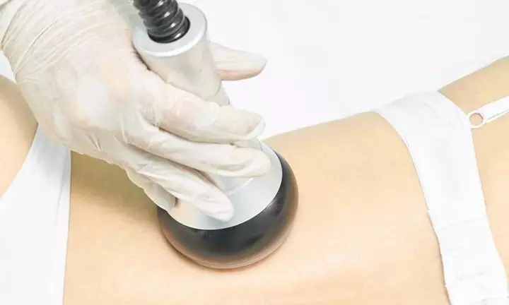 Liposukcja Kawitacyjna, masaż próżniowy z RF lub masaż miodowy