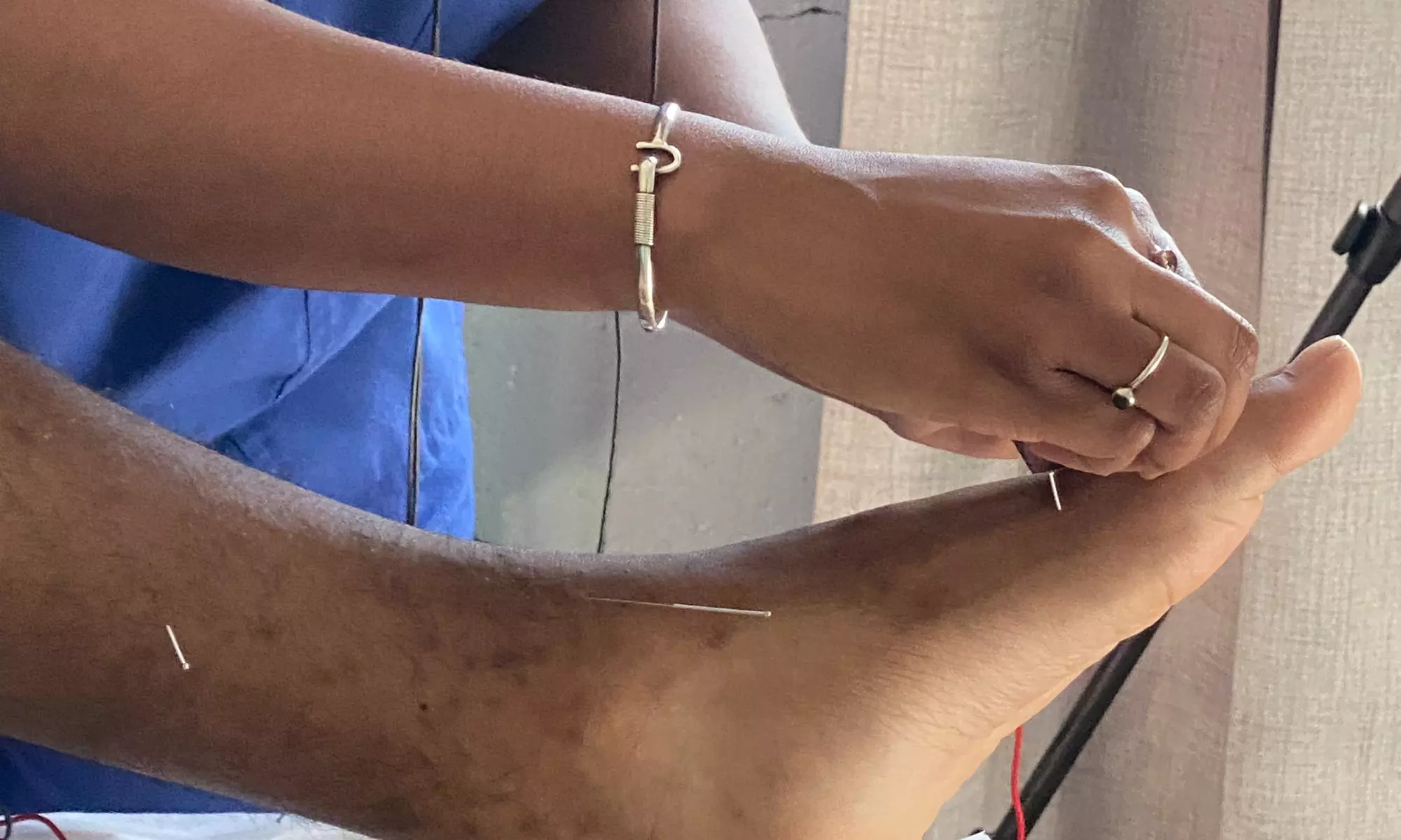 Up to 63% Off on Acupuncture at The Point of Health Wellness Center - Primary Image