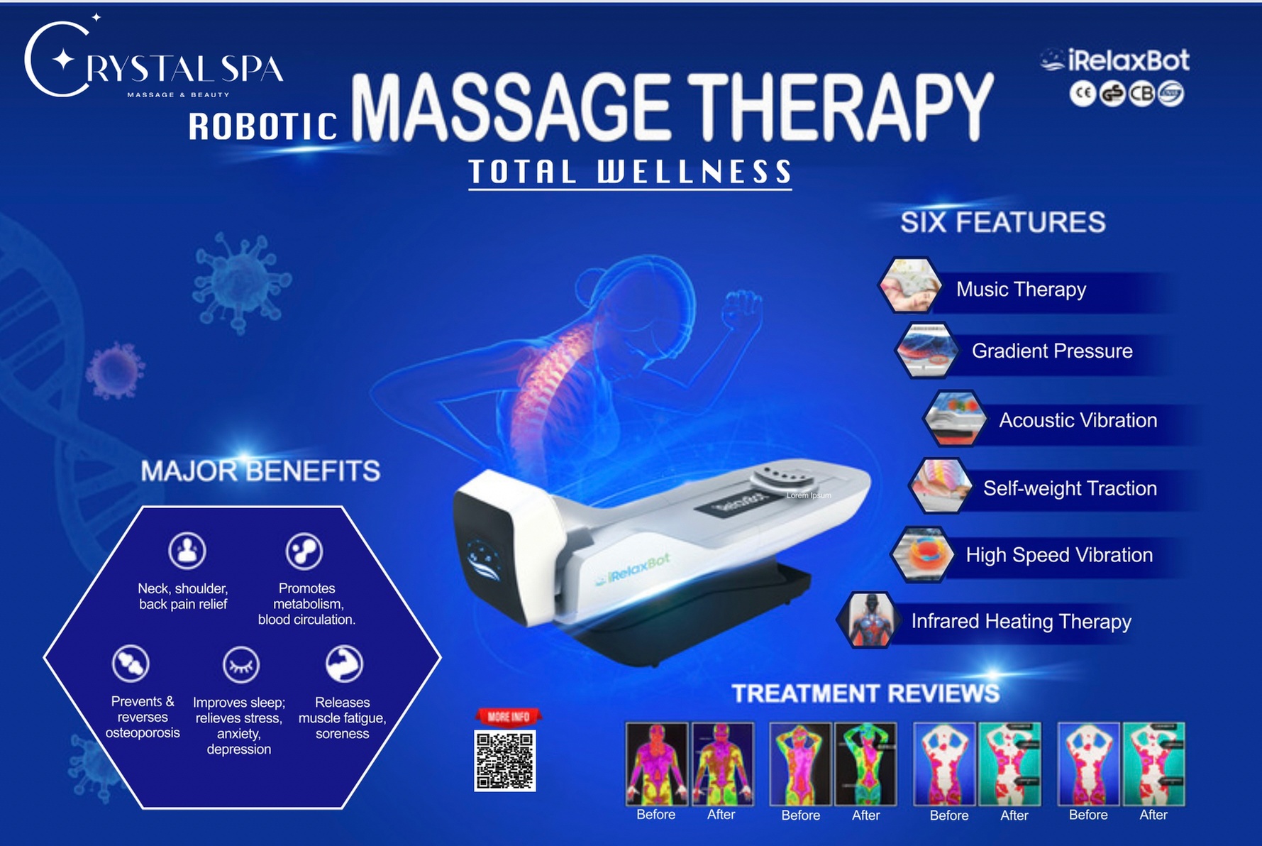 30-Minute iRelaxBot Massage Therapy Sessions for Wellness