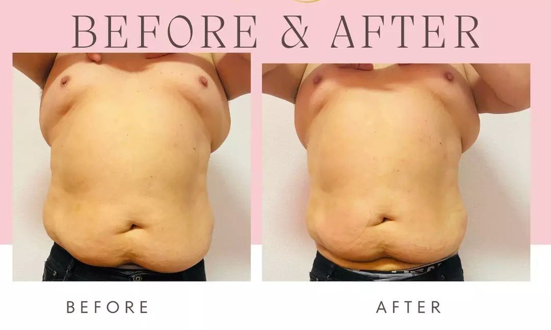 Up to 55% Off on Cavitation at Sexy silhouette by Mari Lu - Second Medium