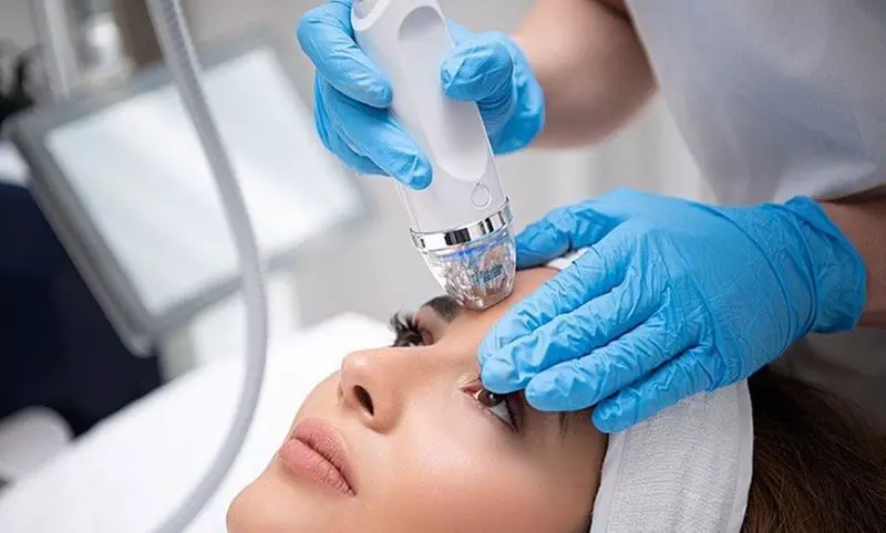 Up to 62% Off on Micro-Needling at ibeauty Med Spa - Primary Image