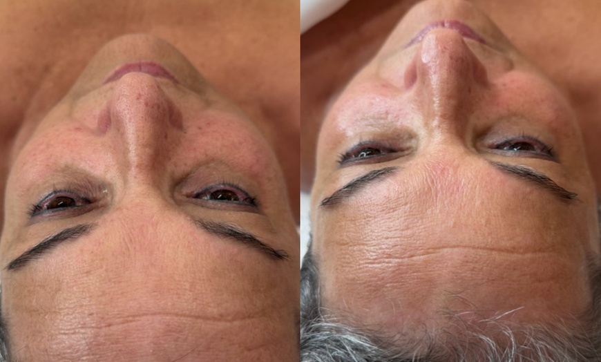 Image 6: Customized Facials for Every Skin Type