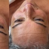 Image 6: Customized Facials for Every Skin Type