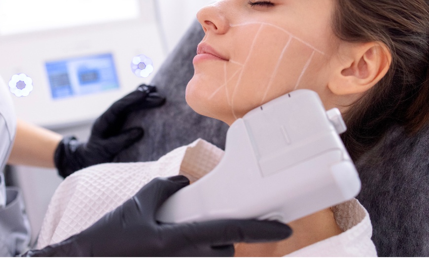 Image 1: Revitalize Your Look with 8D HIFU for Face, Neck, Chin, Jawline and Jowls at NuSkin Beauty (Up to 50% Off)