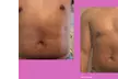 Get Total Body Sculpt, Peach Perfection, / Mommy Makeover Glow Package @ToptierBeautyBody spa (Up to 70% Off) - Second Medium