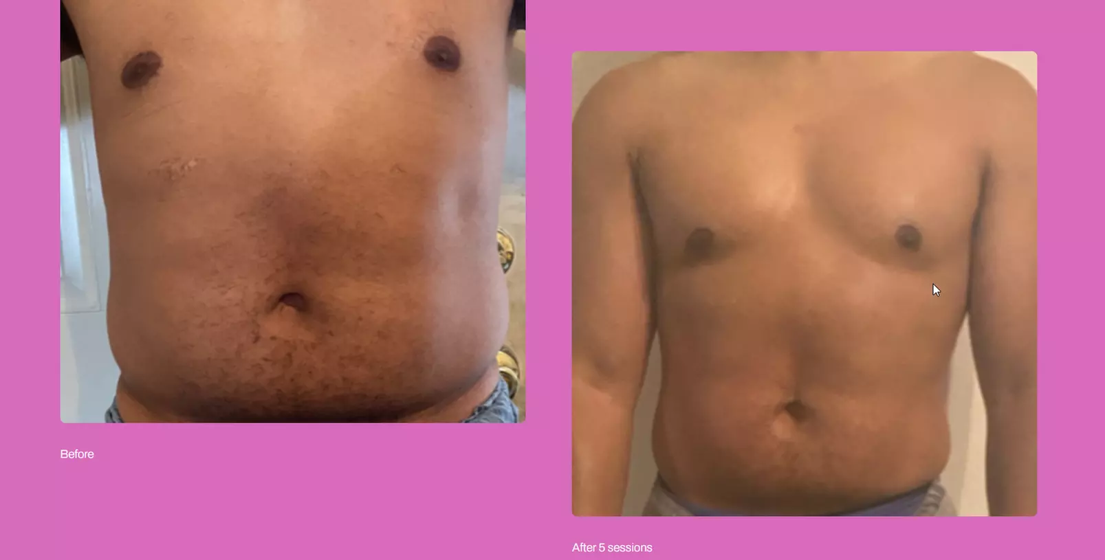 Get Total Body Sculpt, Peach Perfection, / Mommy Makeover Glow Package