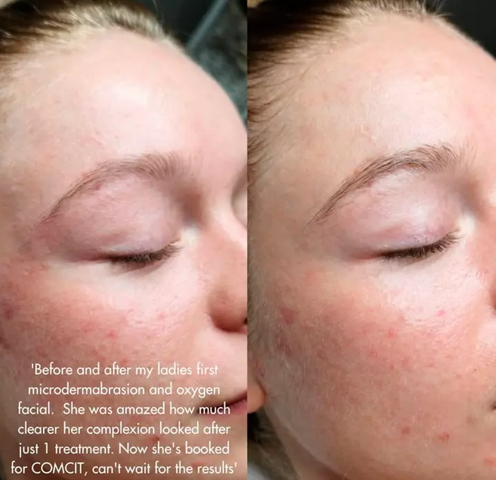 Up to 42% Off on Facial at Diva Beauty SPA Lashes & Brows