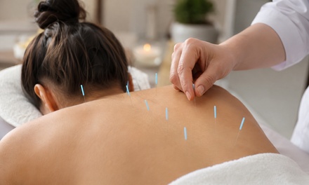 One 30-50 minute Acupuncture Session - Green Chiropractic & Acupuncture