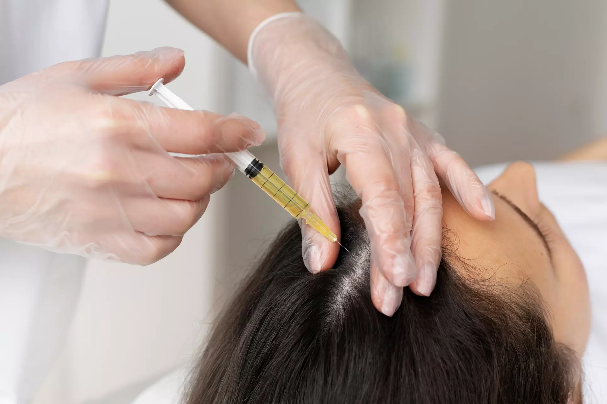 Up to 30% Off on Injection - Plasma at SYRA Aesthetics - Primary Image