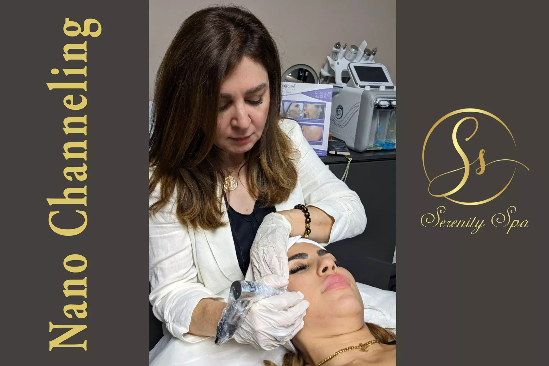 Up to 63% Off on Micro-Needling at Serenity Healing By Lobna