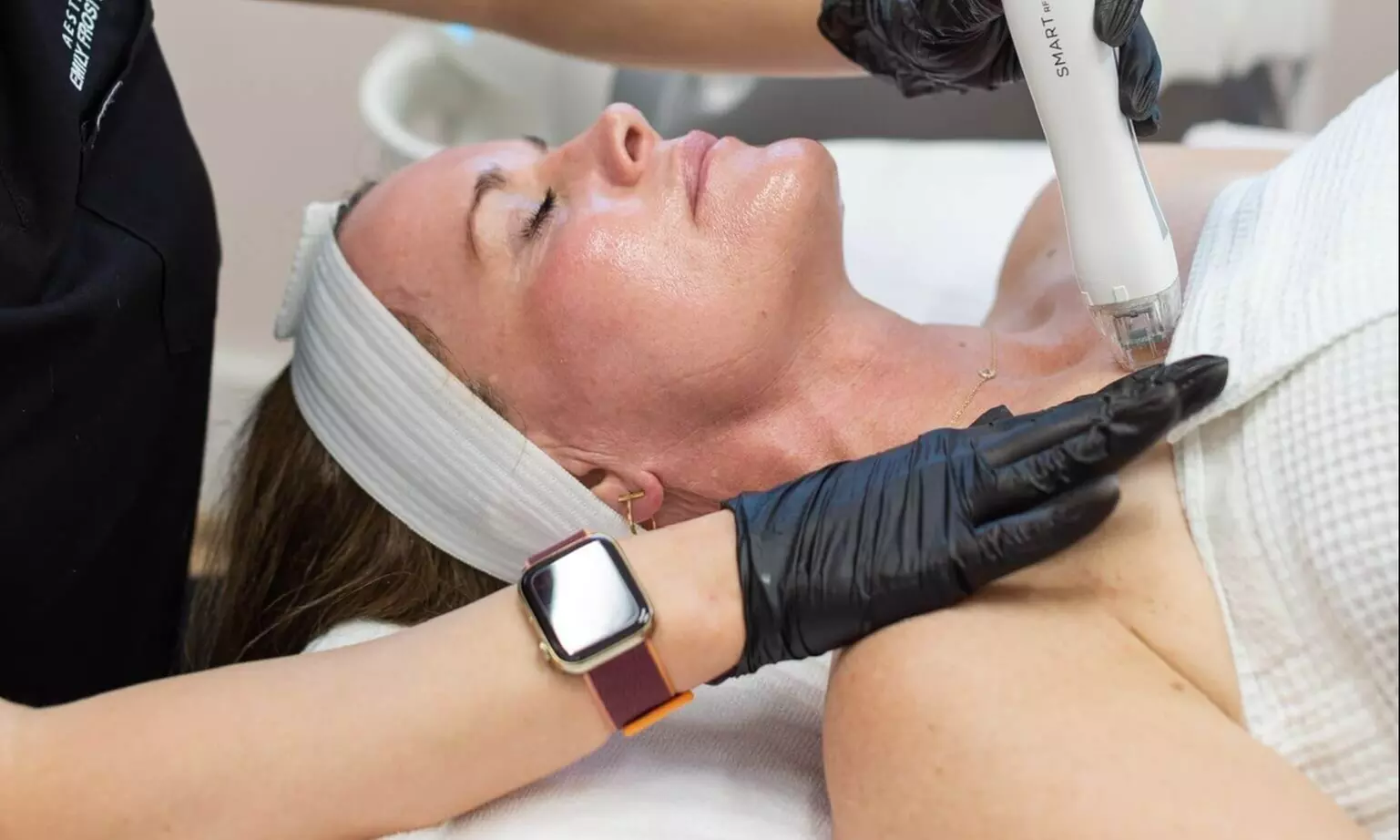 Up to 55% Off on Micro-Needling at UK Aesthetics Lounge