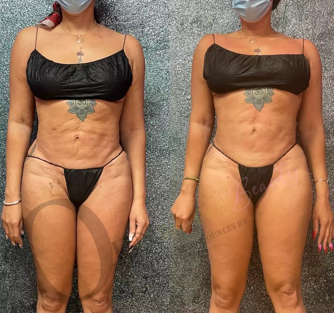 One or Three 60-Minute Body Contour Treatments with Cavitation & More