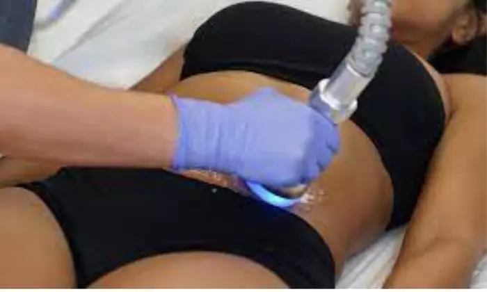 Non-Invasive Skin Tightening Treatments for a Toned Look