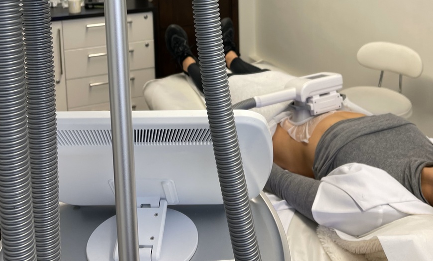 Image 3: Shape Up Your Body with Cryogenic Lipolysis for 1, 2, 3 or 4 Areas