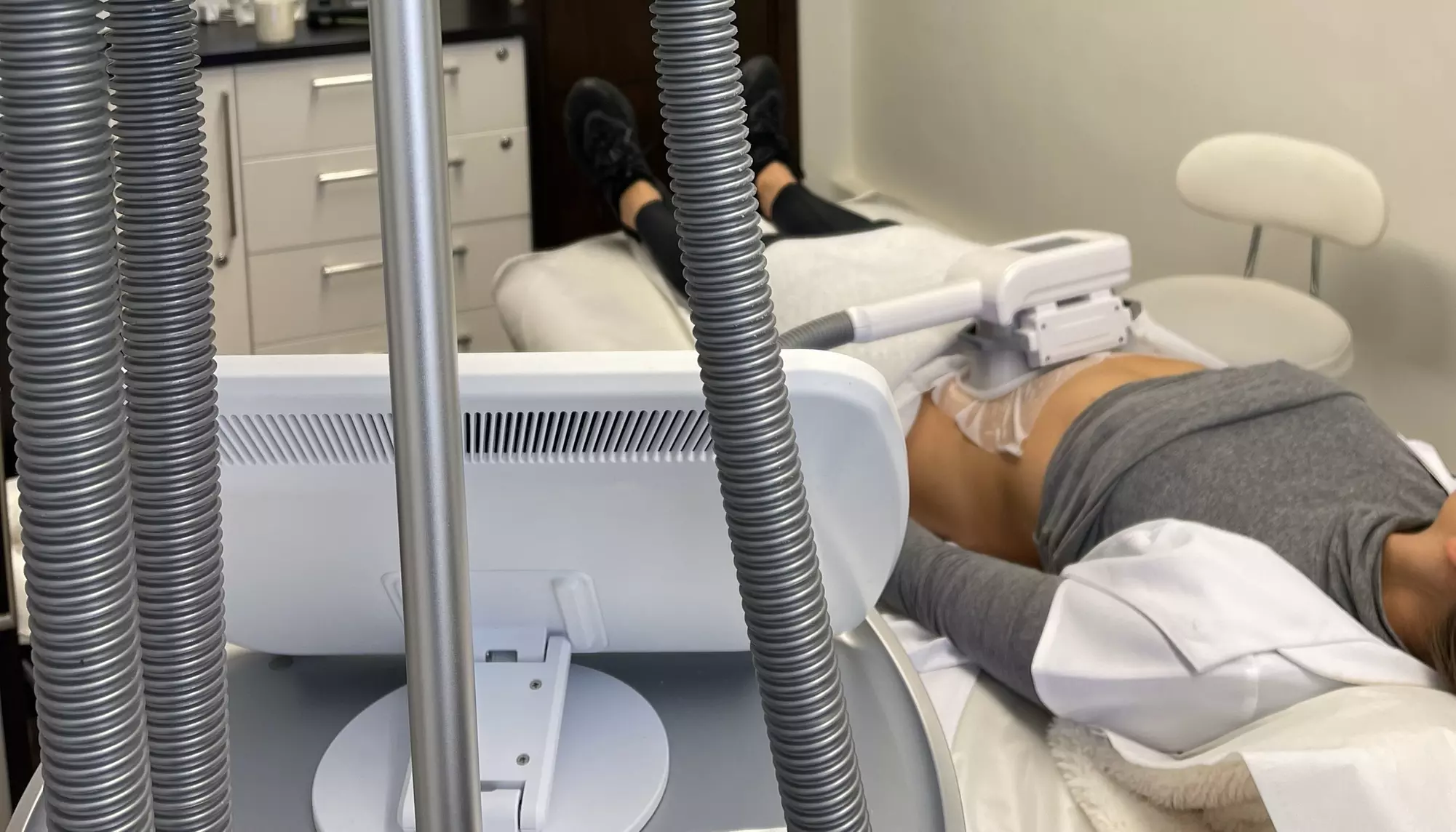 Cryogenic Lipolysis