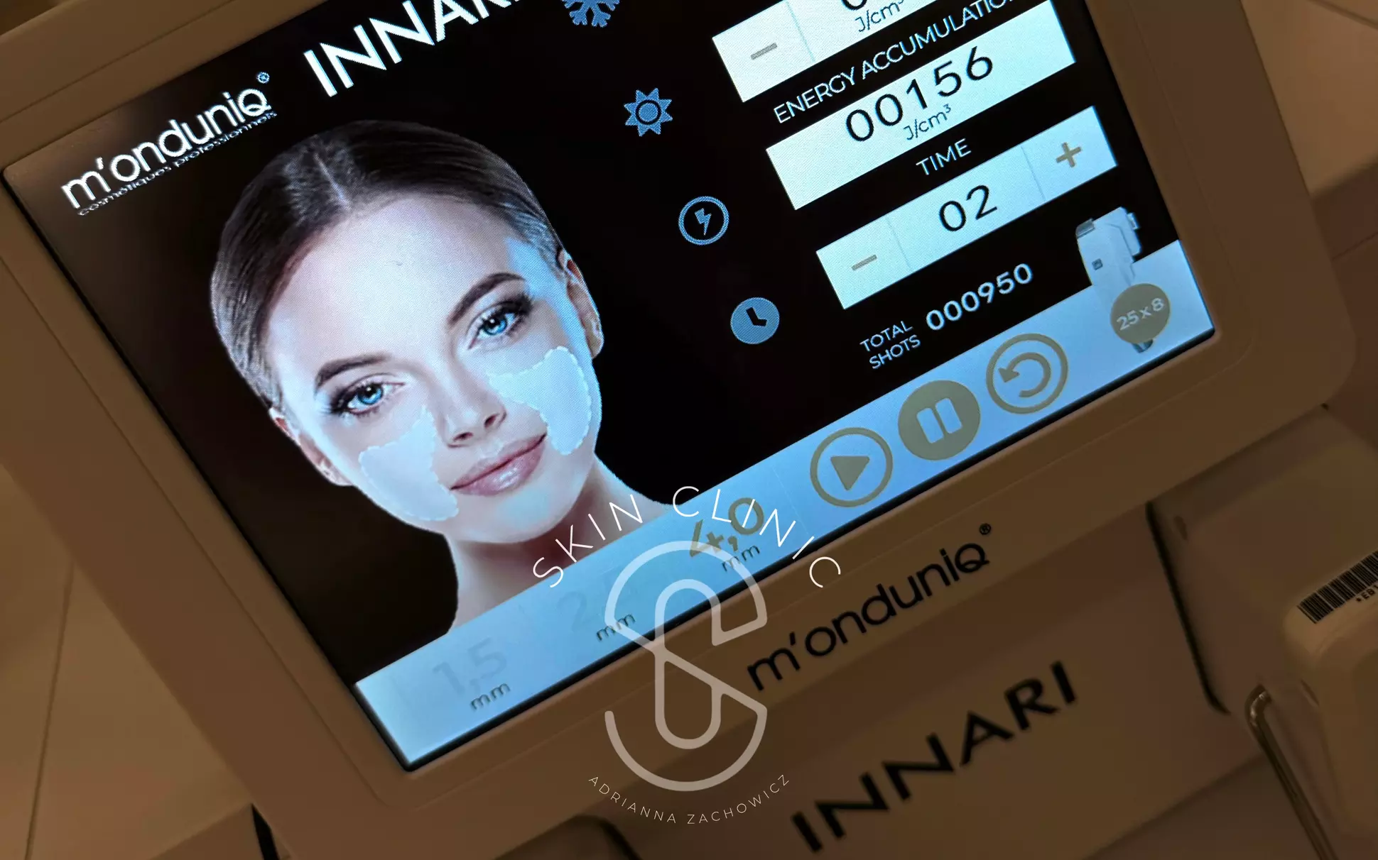 Do 35% zniżki na liftingujący zabieg urządzeniem INNARI® w Skin Clinic Adrianna Petelska - Primary Image