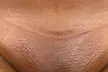 Up to 61% Off on Brazilian / Bikini Waxing at Touched By Tee Spa & Beauty LLC - Second Medium