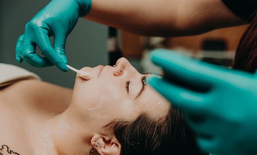 Image 2: Up to 35% Off on Micro-Needling at Panda Pampering