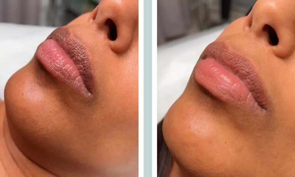 Up to 49% Off on Spa/Salon Beauty Treatments (Services)