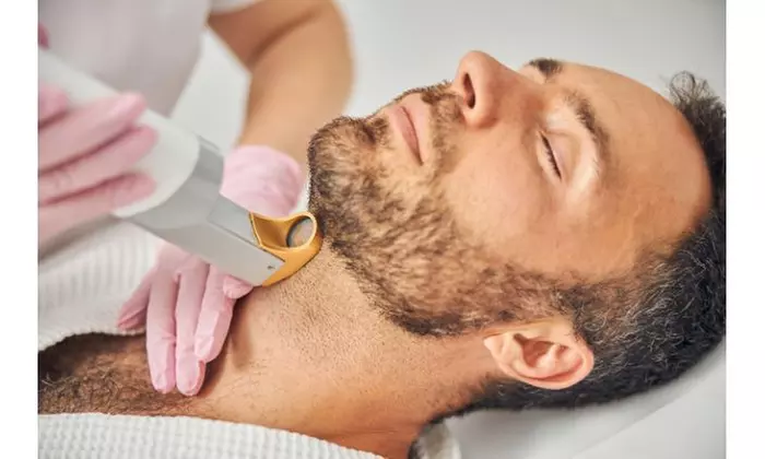 Up to 84% Off on Laser Hair Removal - Men at Pro Laser Hair Removal - Primary Image