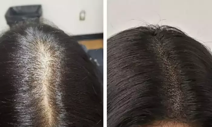 Up to 30% Off on Salon - Scalp Care at Palm Springs SMP - Primary Image