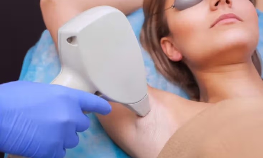 Image 1: Up to 40% Off on IPL Hair Removal at THE MBAR MEDSPA