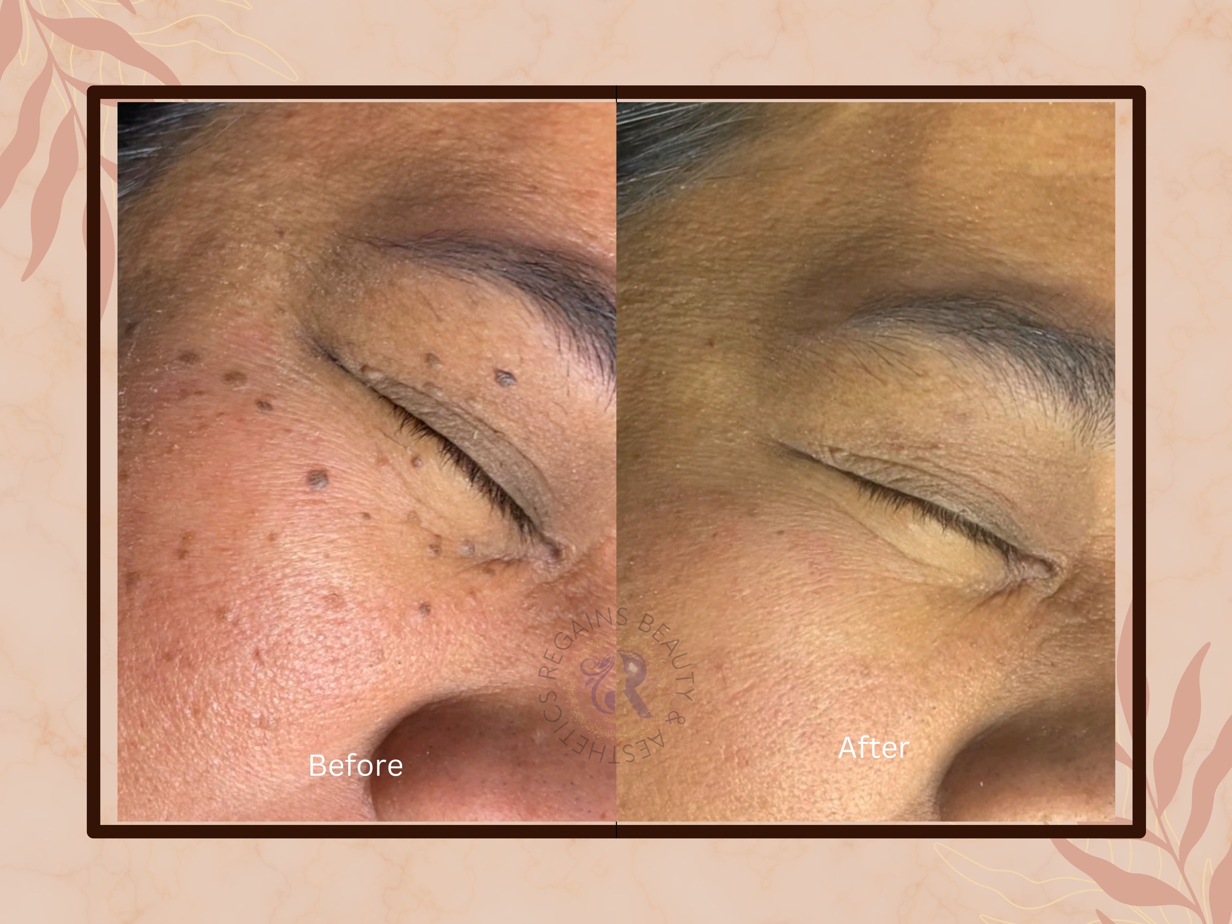 Up to 34% Off on Spa/Salon Beauty Treatments (Services)