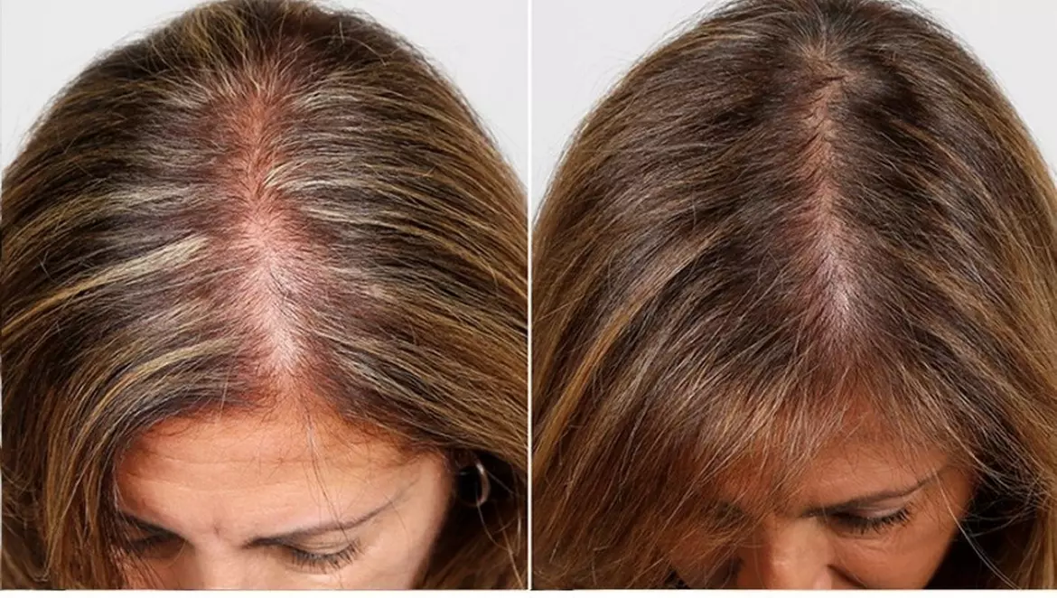 Up to 67% Off on Salon - Hair Straightening Treatment at UK Aesthetics Lounge