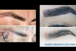 Up to 20% Off on Tattoo Removal at Aesthetic Brows_AM - Second Medium
