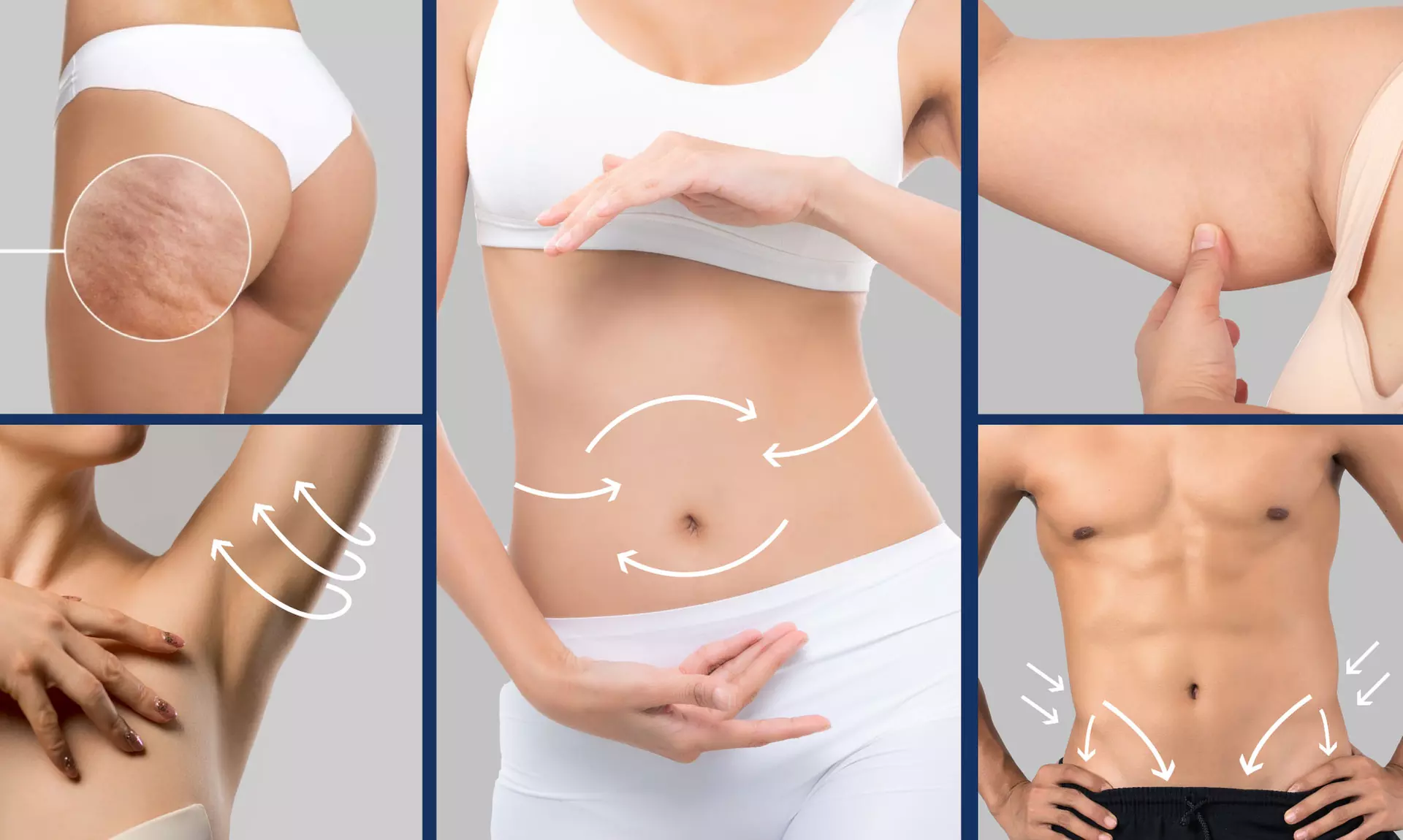 Up to 55% Off on Fat / Cellulite Reduction - Non-Branded at UK Aesthetics Lounge