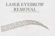 Up to 71% Off on Eyebrow tattoo removal at HL lasers - Second Medium