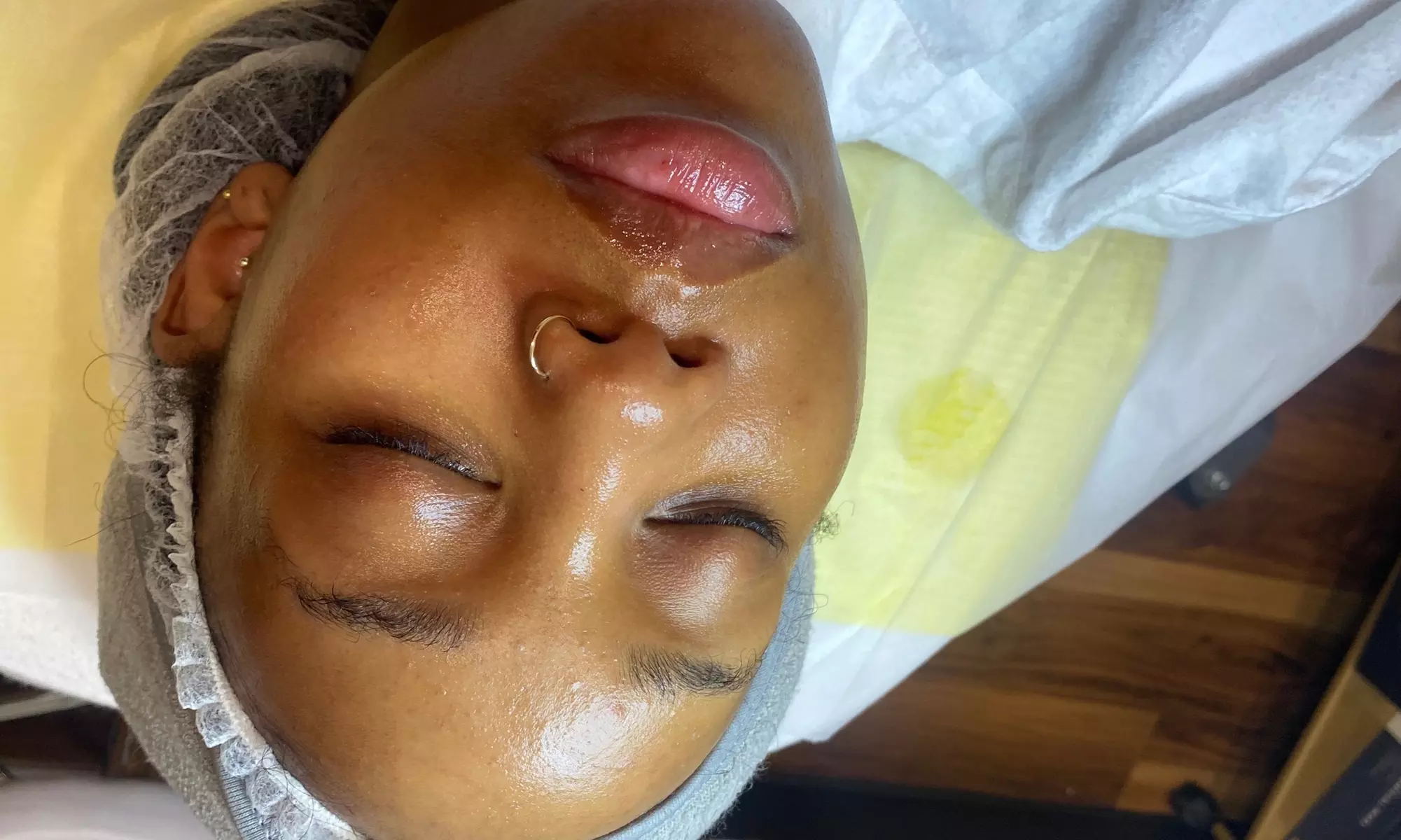 Up to 43% Off on Facial at Balance Choice Care - Second Medium