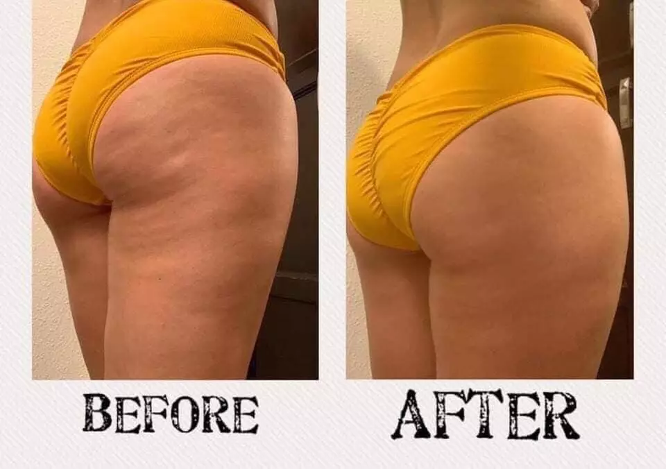 Up to 66% Off on Ultrasonic Fat Reduction at The Final Touch - Second Medium
