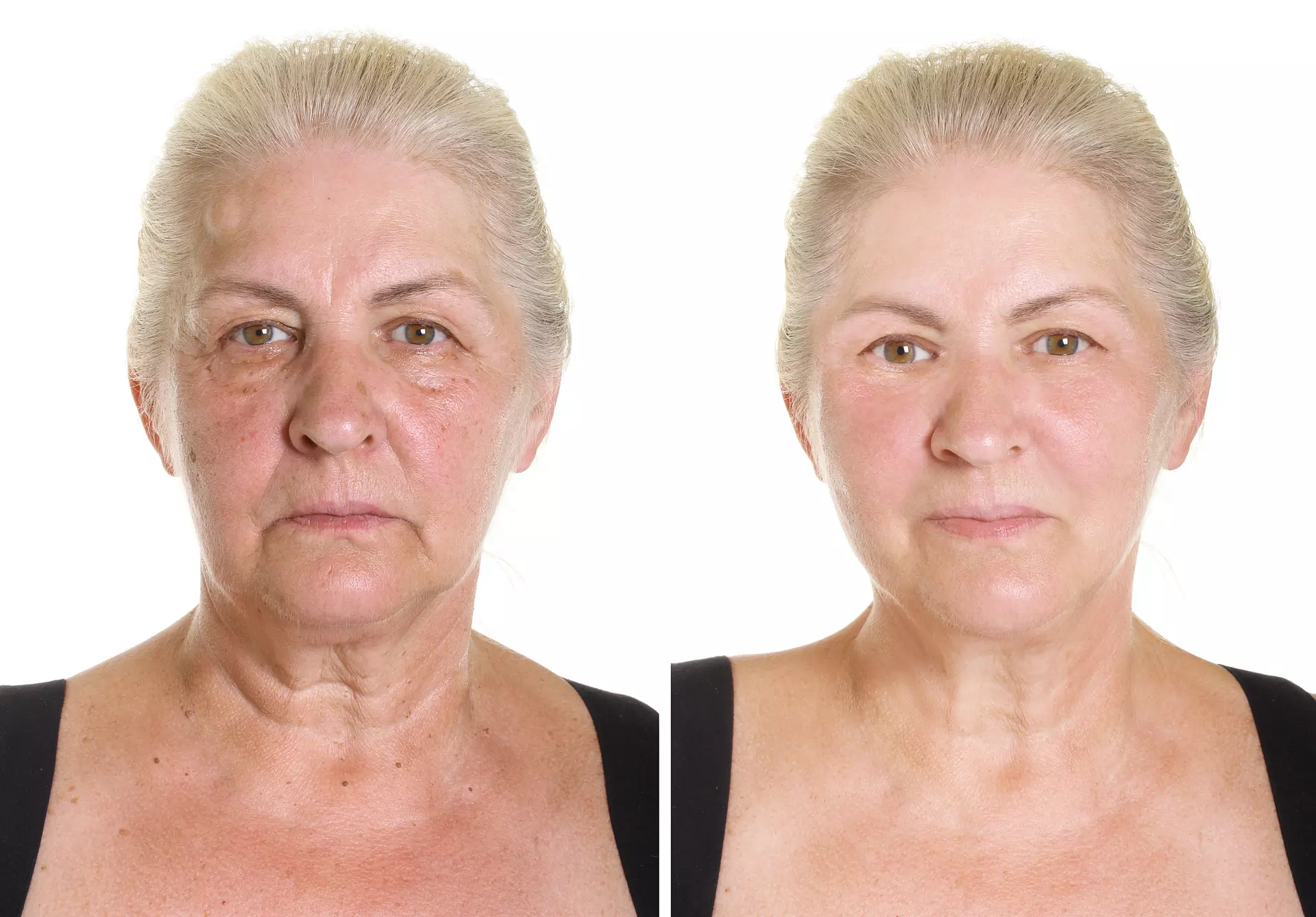 Revitalize Your Look with Holiday Fabulous Skin Treatment