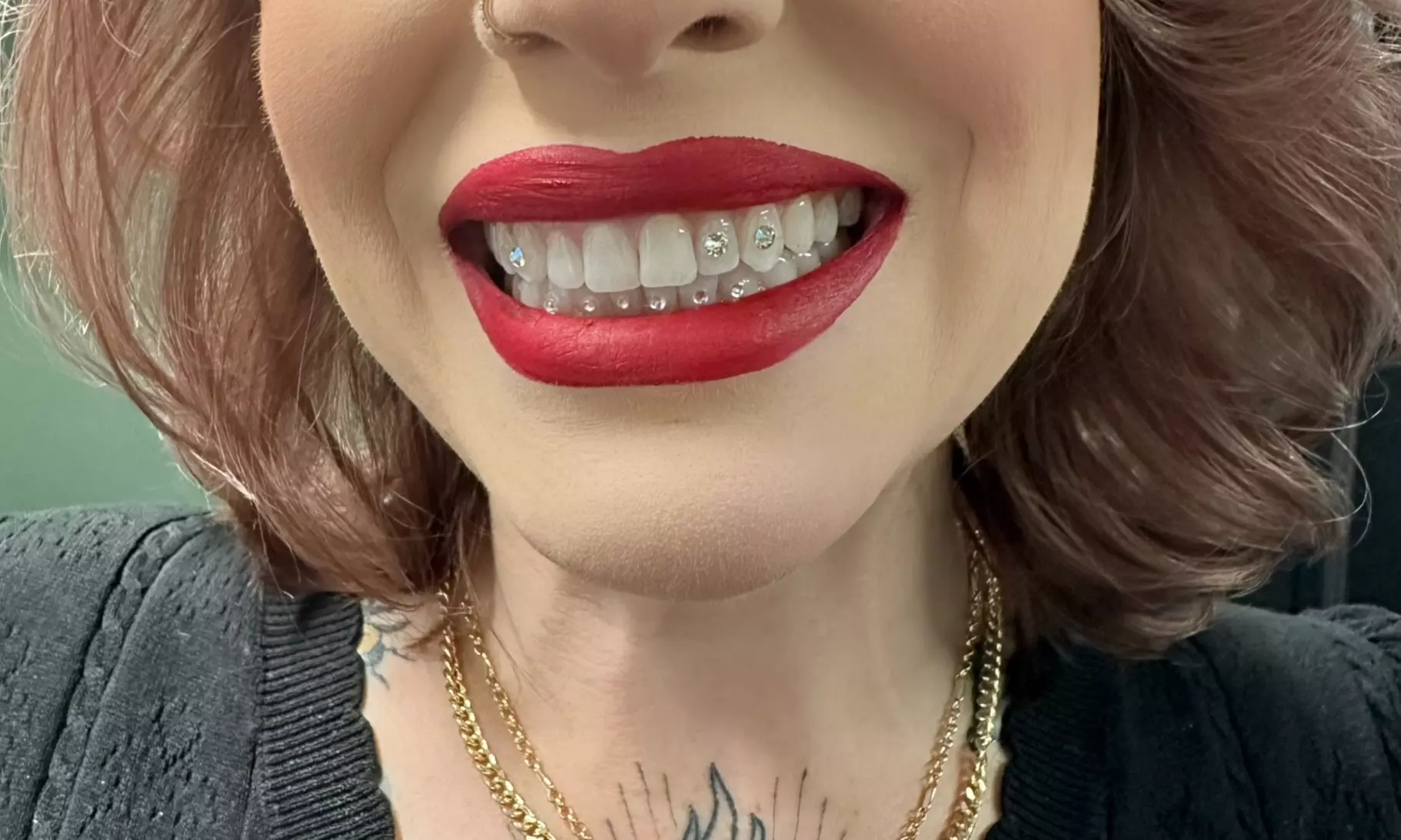 Up to 50% Off on Teeth Whitening at White grill wasted - Primary Image