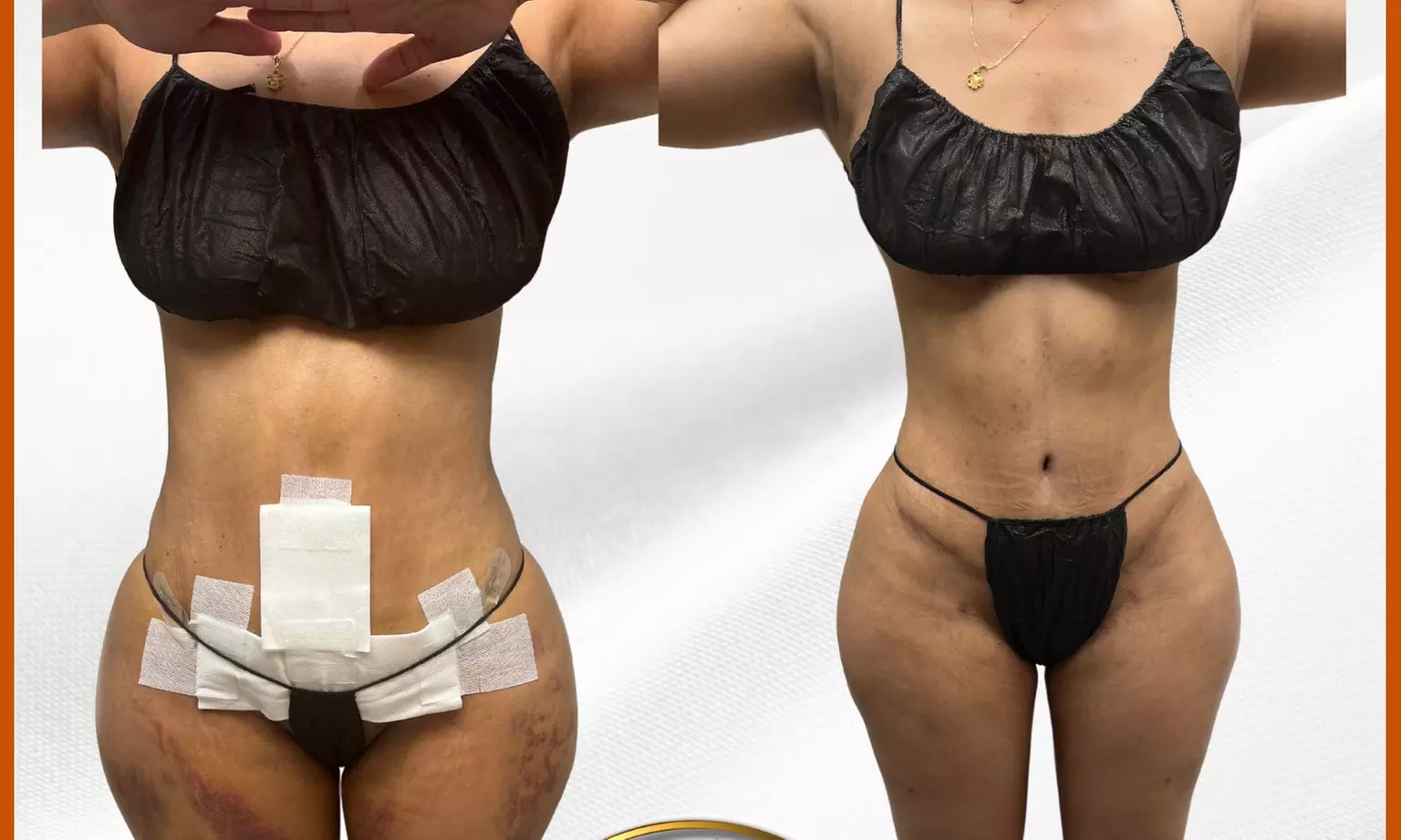 Up to 53% Off on Lymphatic Drainage Massage at Dream Bodyworks Llc