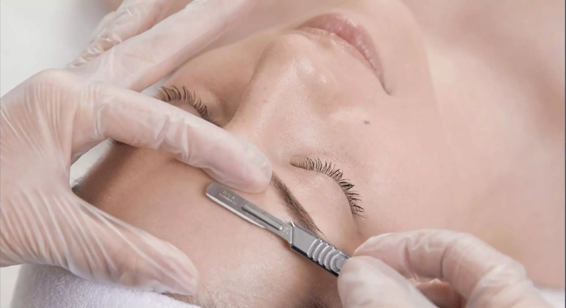 Rejuvenate with Dermaplane & Micro-Needling Treatment Options
