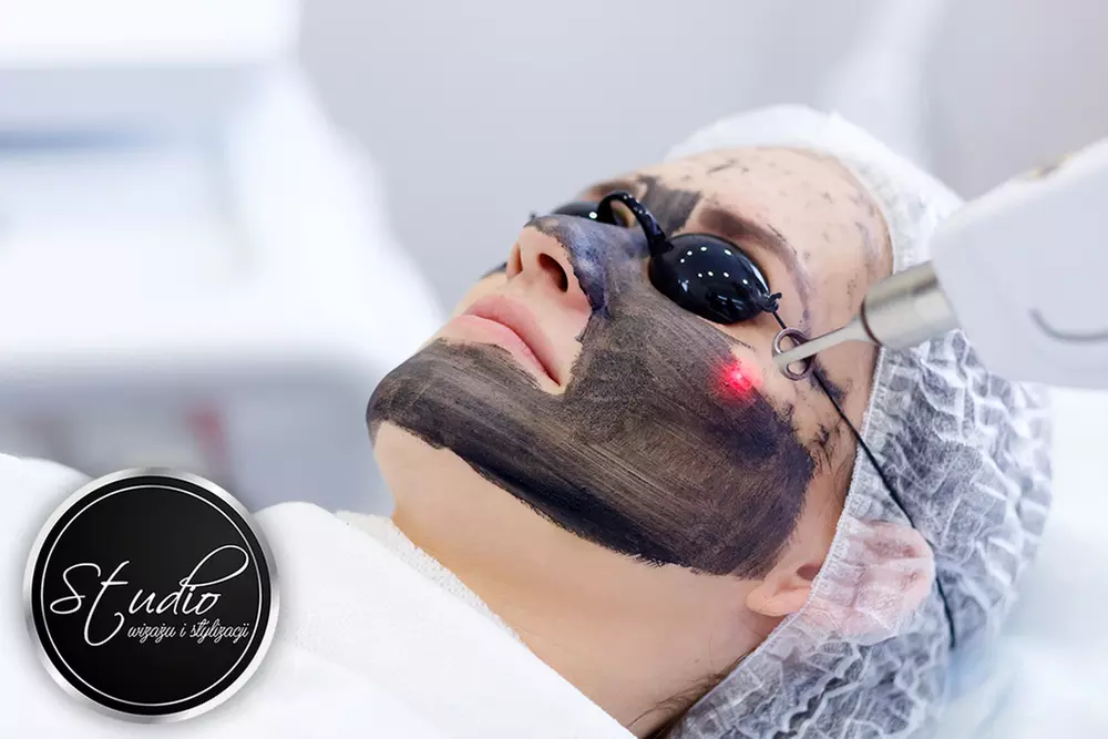 Laserowy peeling węglowy