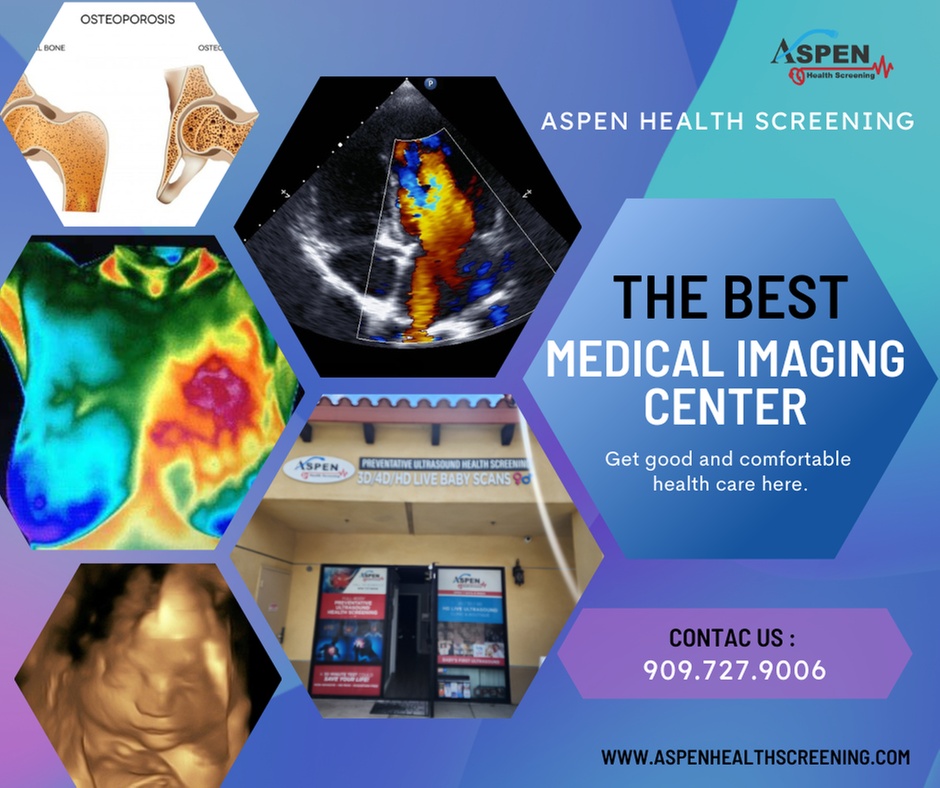 Up to 56% Off on Ultrasound at Aspen Health Screening